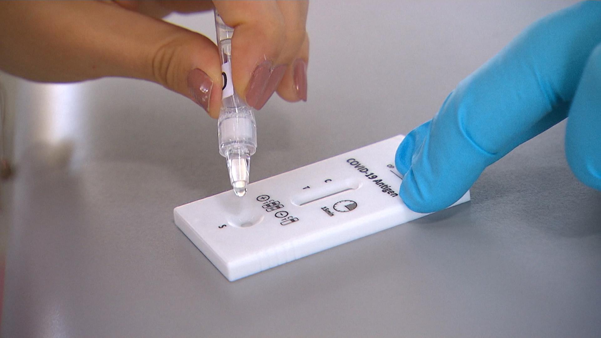 MSH licenson laboratoret private per kryerjen e testit te shpejte